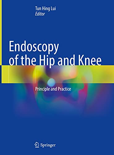 Endoscopy of the Hip and Knee: Principle and Practice (English Edition)