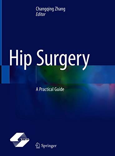 Hip Surgery: A Practical Guide (English Edition)