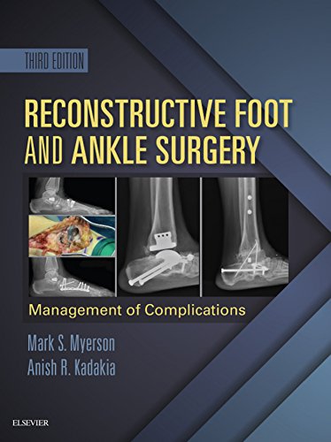 Reconstructive Foot and Ankle Surgery: Management of Complications E-Book: Expert Consult - Online, Print, and DVD (English Edition)