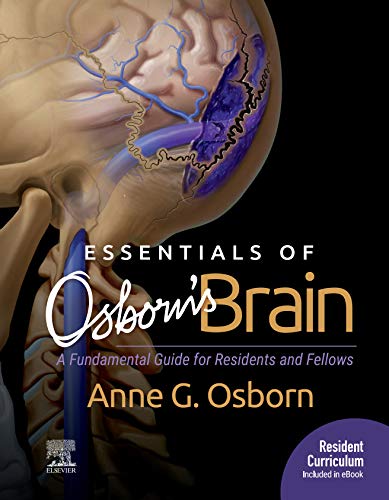 Essentials of Osborn's Brain E-Book: A Fundamental Guide for Residents and Fellows (English Edition)