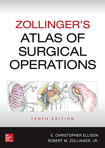 Zollinger's Atlas of Surgical Operations, 10th edition (English Edition)