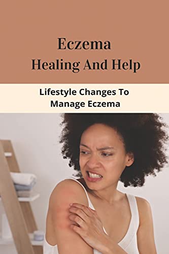 Eczema Healing And Help: Lifestyle Changes To Manage Eczema: What Foods To Eat To Cure Eczema