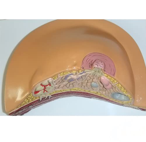 HIMFL Modelo anatómico de la anatomía de la estructura del pecho femenino Modelo patológico del cáncer de la enfermedad del pecho para la ayuda del entrenamiento de la educación de la medicina