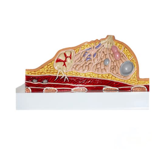 HIMFL Modelo anatómico de la anatomía de la estructura del pecho femenino Modelo patológico del cáncer de la enfermedad del pecho para la ayuda del entrenamiento de la educación de la medicina