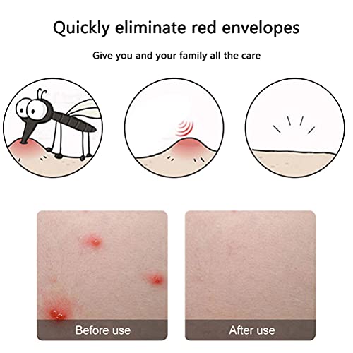 Hspemo Mosquito Bites Device - Dispositivo electrónico de curación contra picazón, picaduras de insectos, dolor e hinchazón de picaduras de mosquitos, avispas, tábanos, sin productos químicos