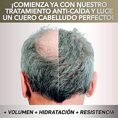 Potente tratamiento anticaída para el cabello | Activador del crecimiento del cabello | Aumenta el volumen y la densidad del pelo | Apto para hombres y mujeres | Resultados 100% visibles | 30 cápsulas
