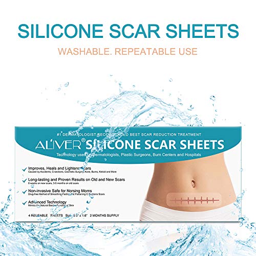 Silicone Scar Sheets, Hojas de silicona para eliminar cicatrices, Hojas de tratamiento de cicatrices de acné, Quemaduras, Acné, Cicatrices quirúrgicas de cesárea