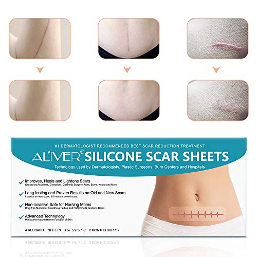 Silicone Scar Sheets, Hojas de silicona para eliminar cicatrices, Hojas de tratamiento de cicatrices de acné, Quemaduras, Acné, Cicatrices quirúrgicas de cesárea