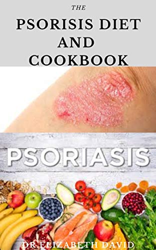 THE PSORIASIS DIET AND COOKBOOK: Dietary Guide For Preventing and Healing Psoriasis : Includes Delicious Recipe ,Meal Plan and Cookbook (English Edition)