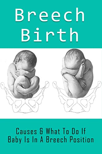 Breech Birth: Causes & What To Do If Baby Is In A Breech Position (English Edition)