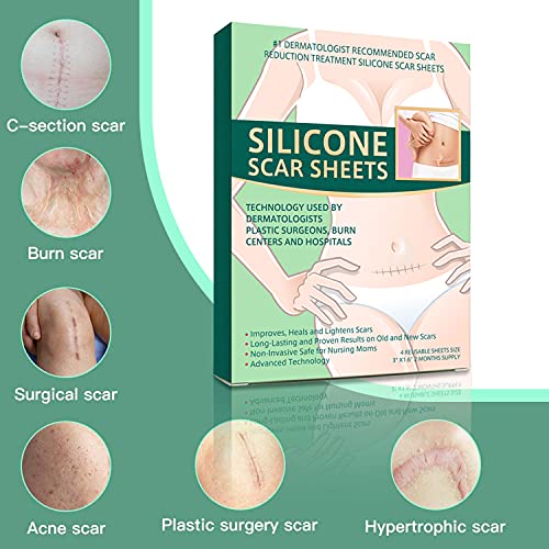 Thnkstaps 4 piezas Hojas de silicona para eliminar cicatrices Sábanas de Cicatriz Hojas de tratamiento de cicatrices de acné Silicone Scar Sheets por C-Section, cirugía, quemaduras